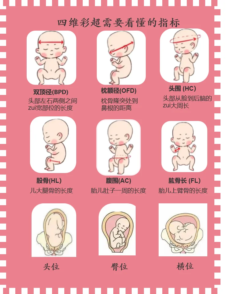 一次性搞懂四维彩超检查报告,国内供卵花多少钱&最好代孕公司