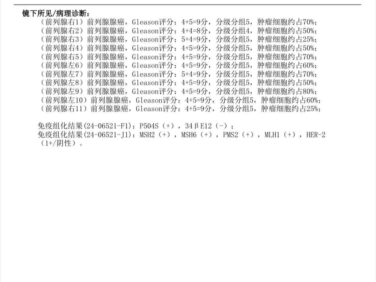 前列腺晚期骨转移,代孕供精包成功